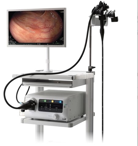 Máy nội soi tiêu hóa EP-6000